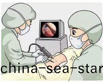 萬至(zhi)達關節鏡鑤刀(dao)電機的(de)優勢